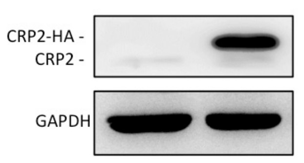 CRP2 protein level in MCF-7 cell lines.jpg